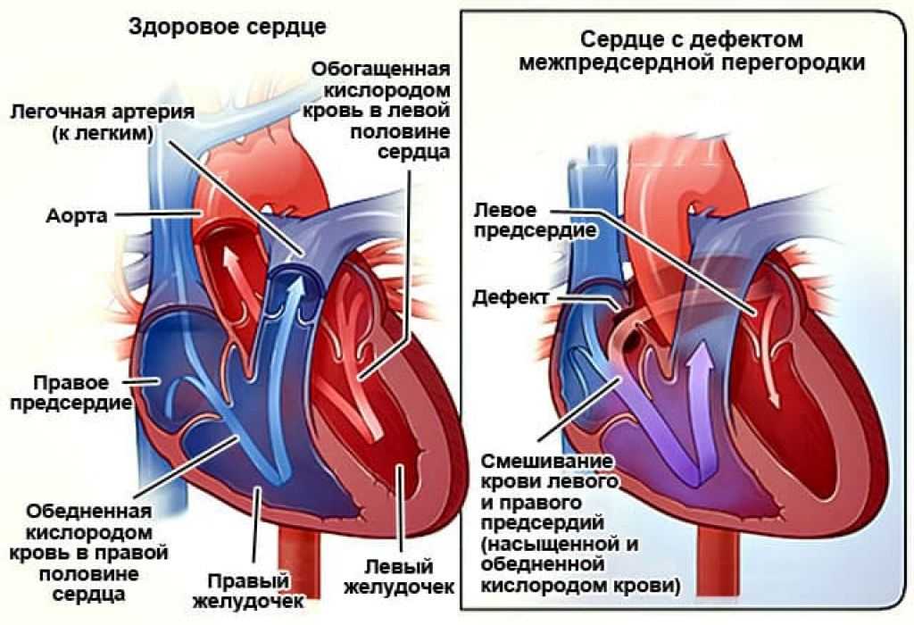 О каком времени идет речь? «немцы посыпались в россию, как сор из дырявого мешка, облепили двор, обс - узнавалка.про