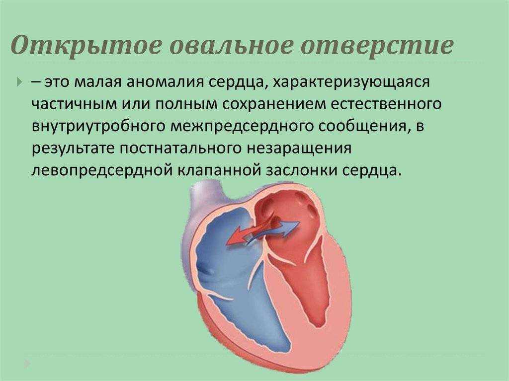 Разрыв сердца: причины и типы, симптомы, лечение и прогноз жизни