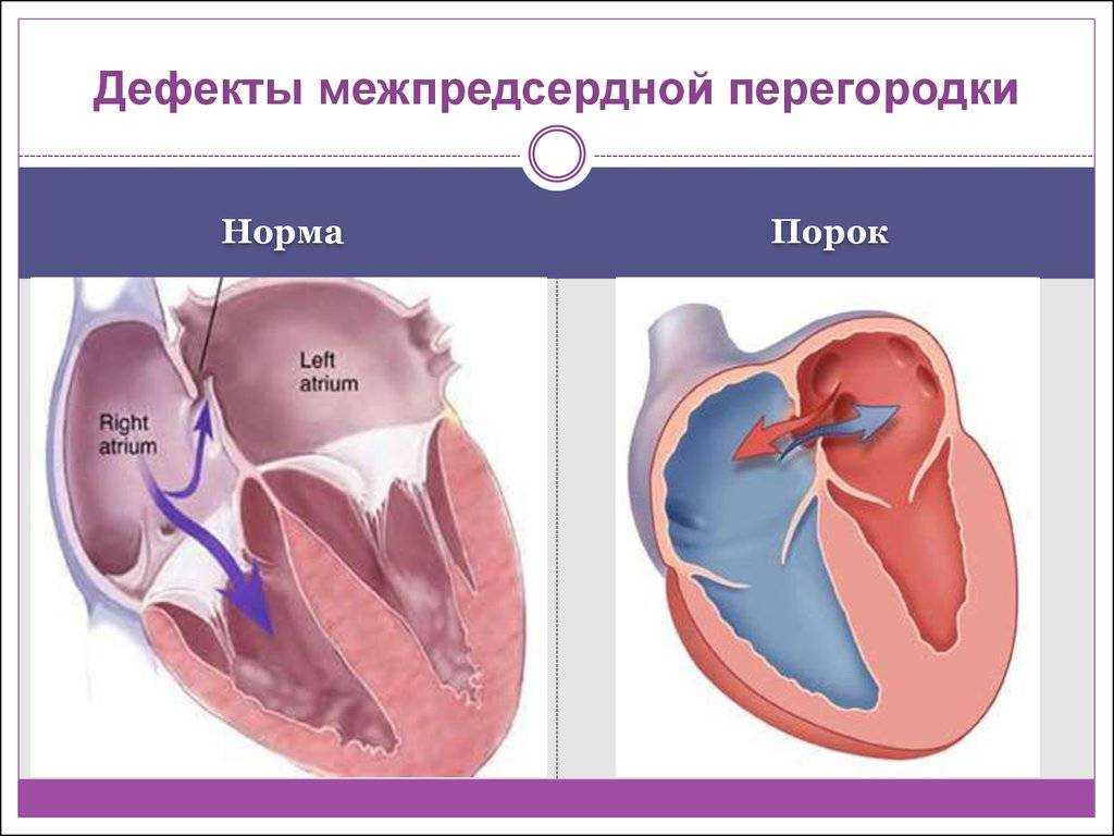 Как красиво зашить дырку вышивкой
